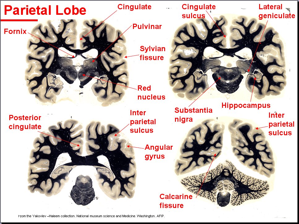 Salamons Neuroanatomy And Neurovasculature Web Atlas Resource